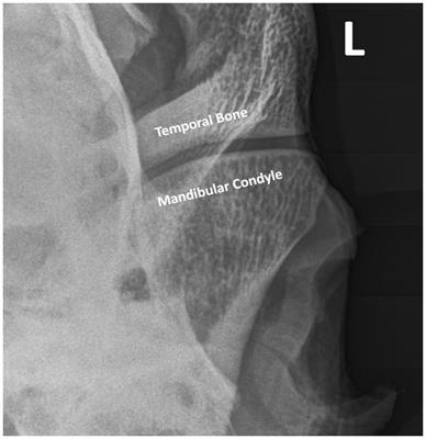 Contrast arthrography of the equine temporomandibular joint